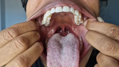 GoldenLace's Grand Oral Tour: Uvulafesties, Tongue & Mouth Fetishes