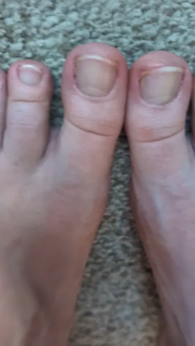 Mplfeet Vip 03 04 2026 - A Beautiful Day Outside - Onlyfans Video Toes Domination