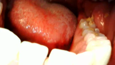 GoldenLace goes wild on Manyvids with her mouth and teeth