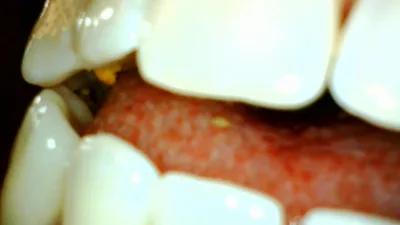 GoldenLace's Giant Teeth and Eating Skills on ManyVids